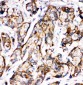 Anti-Sonic Hedgehog Antibody